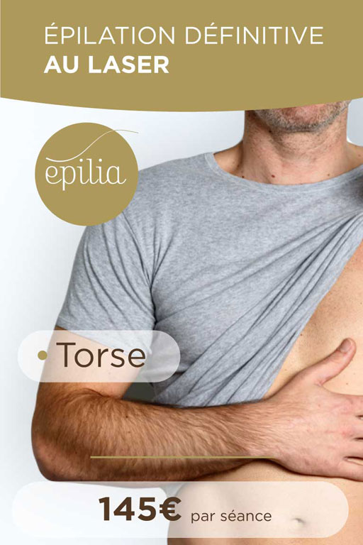 epilation laser torse namur mob